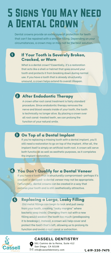5 Signs You May Need a Dental Crown