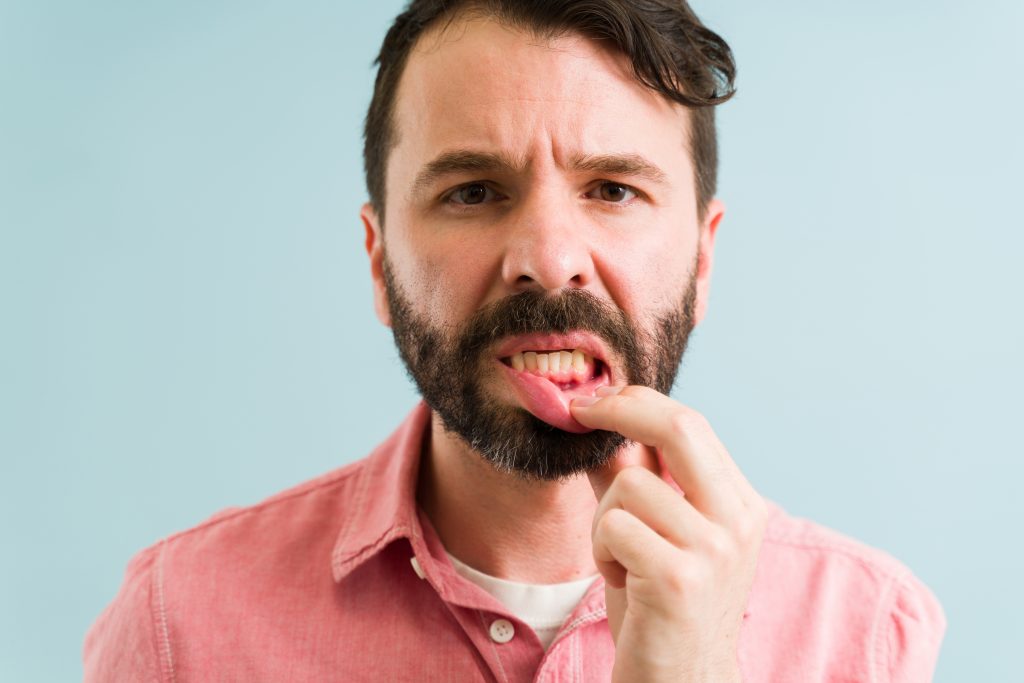 Gum Disease Treatment in Mission Valley