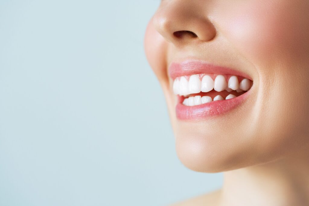 What Are The Best Teeth Whitening Options?